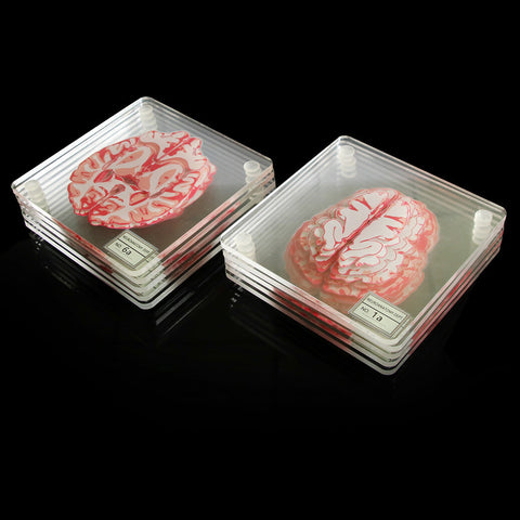 Creative Floral Brain Slices Acrylic Coasters Party Favors