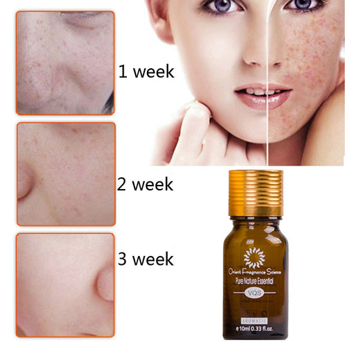 Dredge Meridian Skin Care Natural Pure Removal Acne Stretch Marks Scar Removal Essence oil