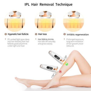 Laser hair removal device - Minihomy