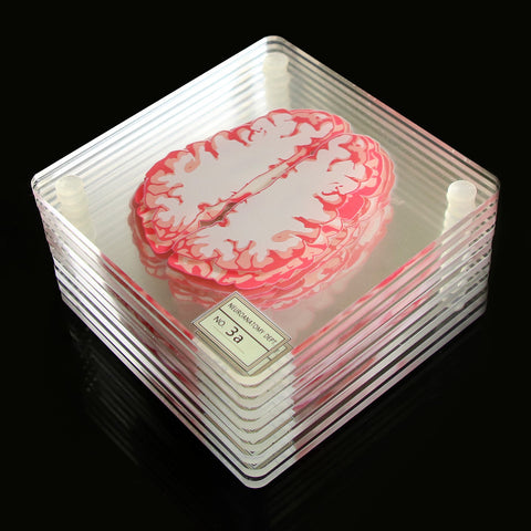 Creative Floral Brain Slices Acrylic Coasters Party Favors